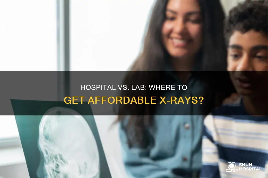 which is less expensive for xray a hospital or lab