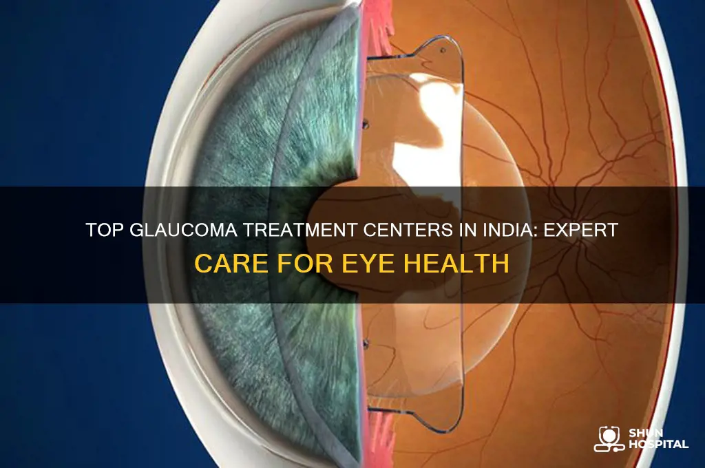 which is the best eye hospital for glaucoma in india