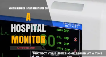 Understanding the Heart Rate Display on Hospital Monitors: A Guide