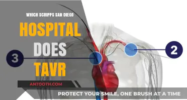 Scripps San Diego TAVR: Which Hospital Performs the Procedure?