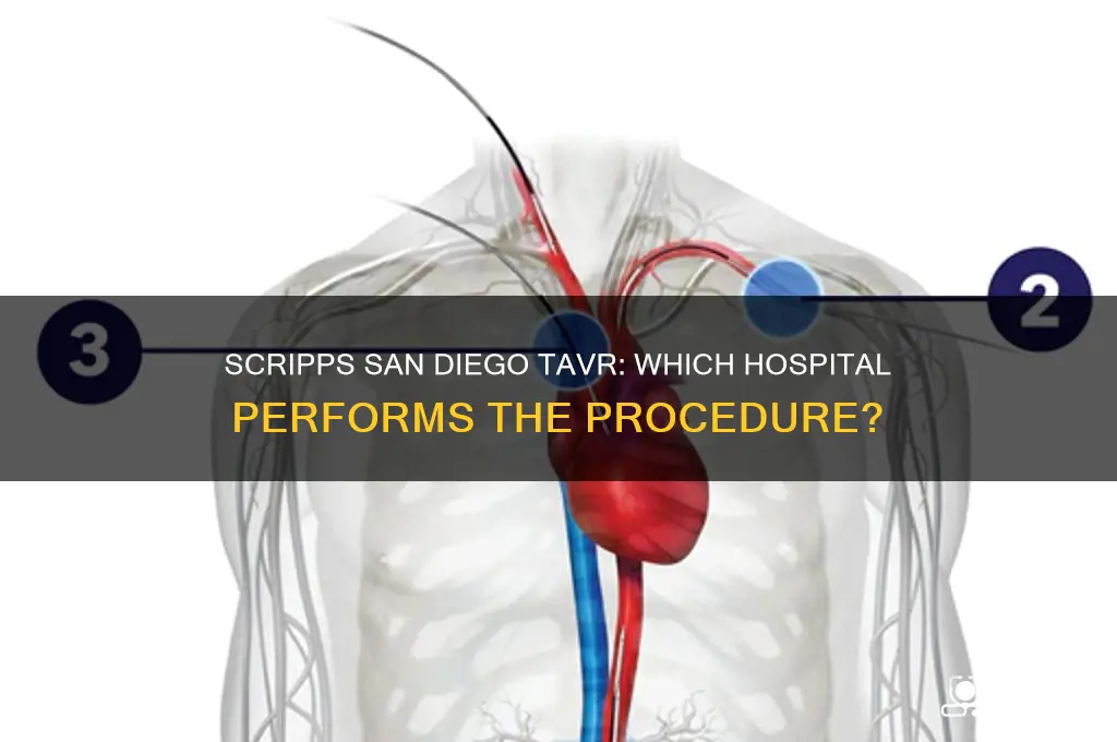 which scripps san diego hospital does tavr