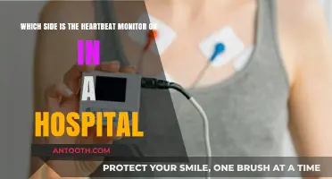 Where’s the Heartbeat Monitor Placed in Hospital Beds: A Quick Guide