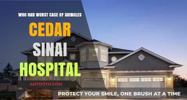 Cedar Sinai's Shingles Nightmare: Who Suffered the Most Severe Case?
