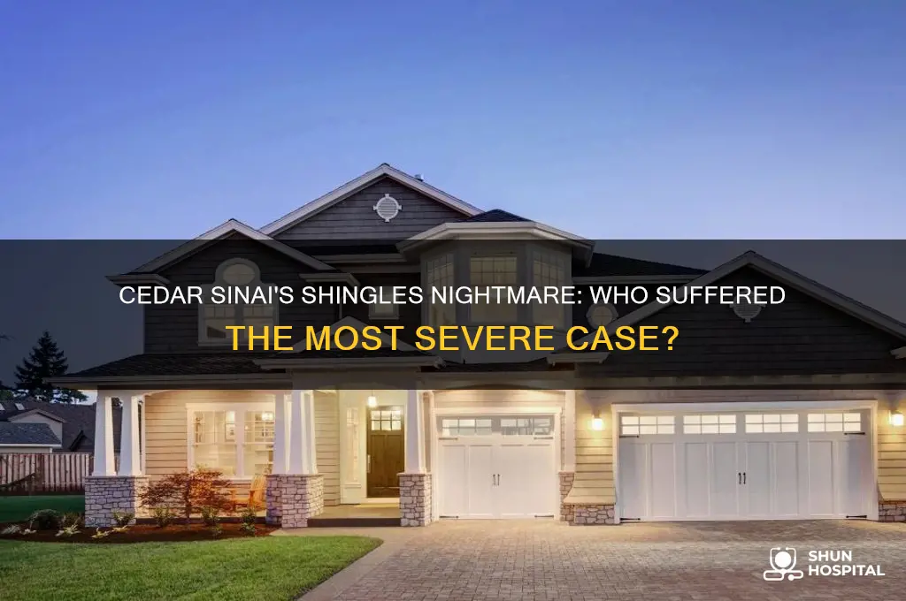 who had worst case of shingles cedar sinai hospital