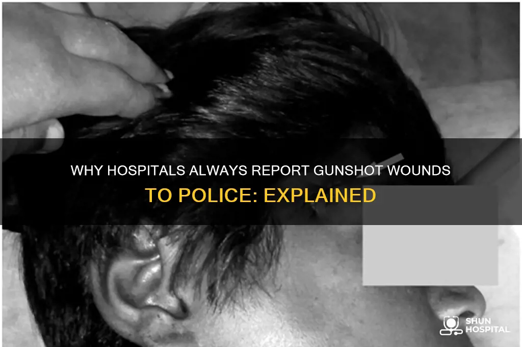 why are gunshots always reported to police in hospitals
