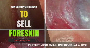 The Dark Truth: Hospitals Selling Foreskin