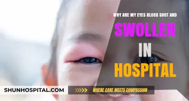 Hospital Stay Eye Concerns: Understanding Bloodshot and Swollen Eyes