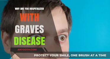 Hospitalization from Graves' Disease: When and Why?