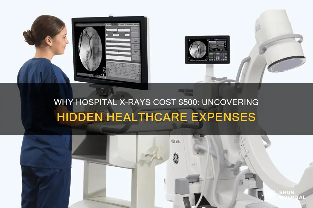 why did my hospital x-ray cost me 500