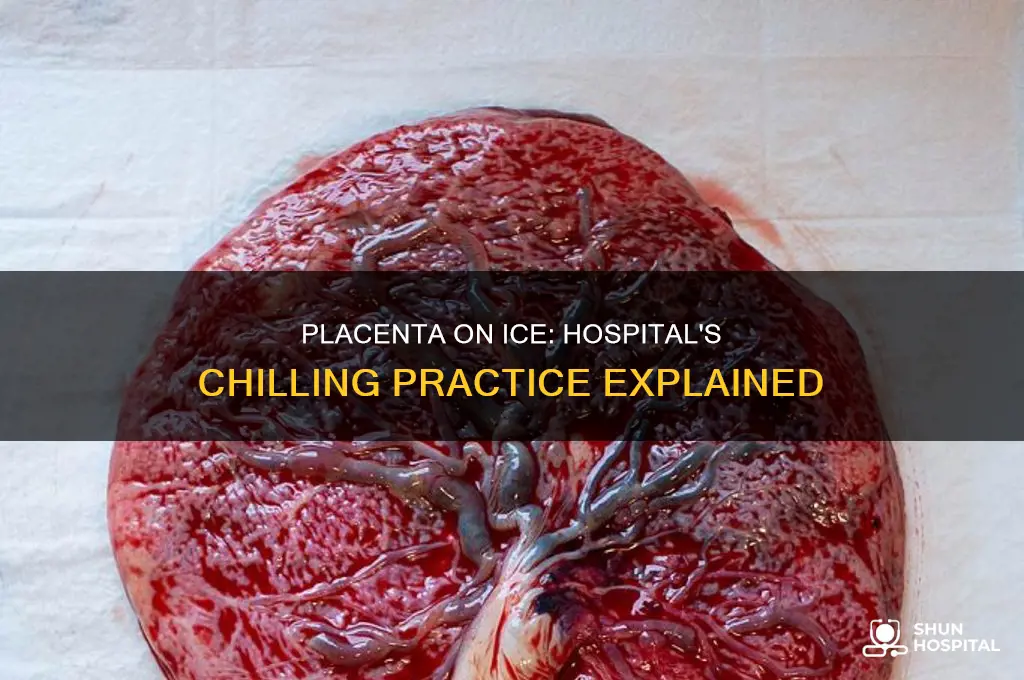 why did the hospital put the placenta on ice