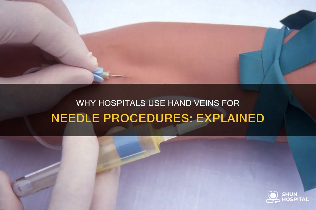 why do hospital put needle in top of hand