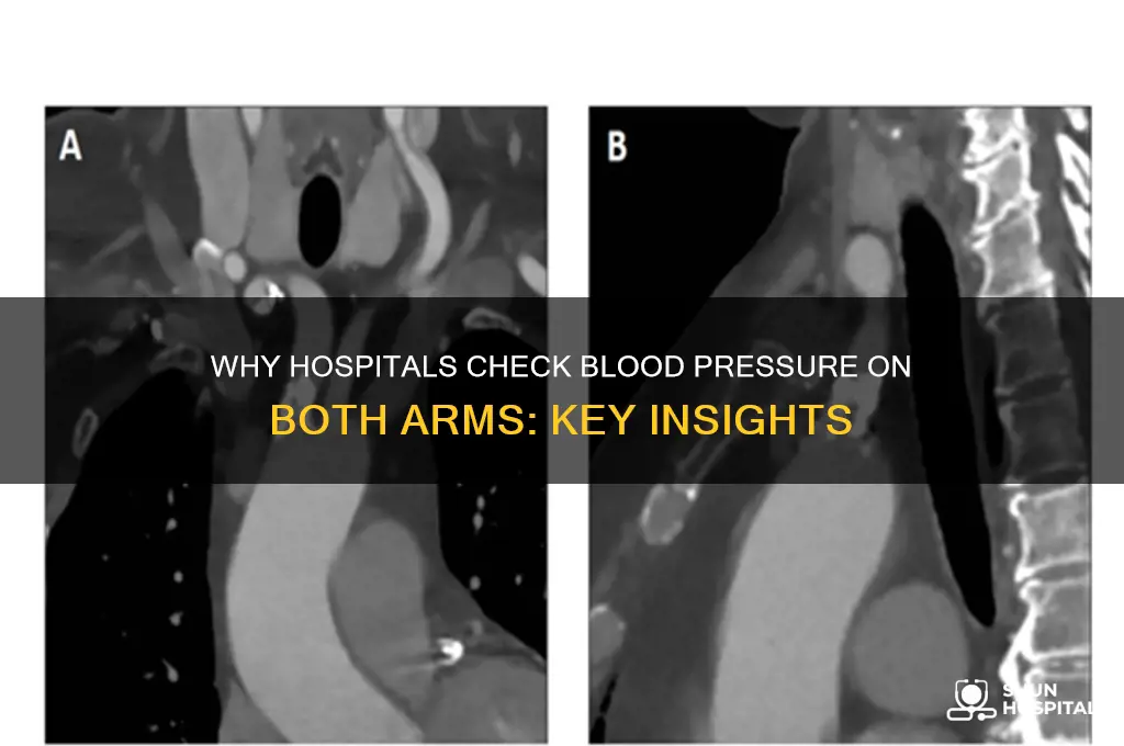 why do hospitals check blood pressure on both arms