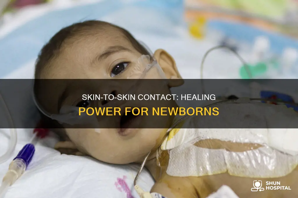 why do hospitals do skin to skin