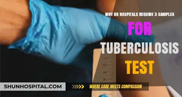 Why Hospitals Demand Three Samples for Accurate Tuberculosis Testing