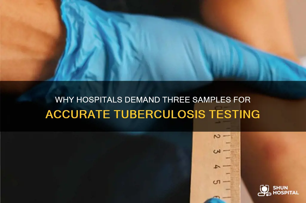 why do hospitals require 3 samples for tuberculosis test