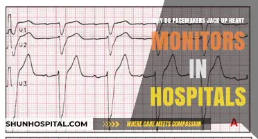 Pacemakers and Heart Monitors: Unraveling Hospital Interference Issues
