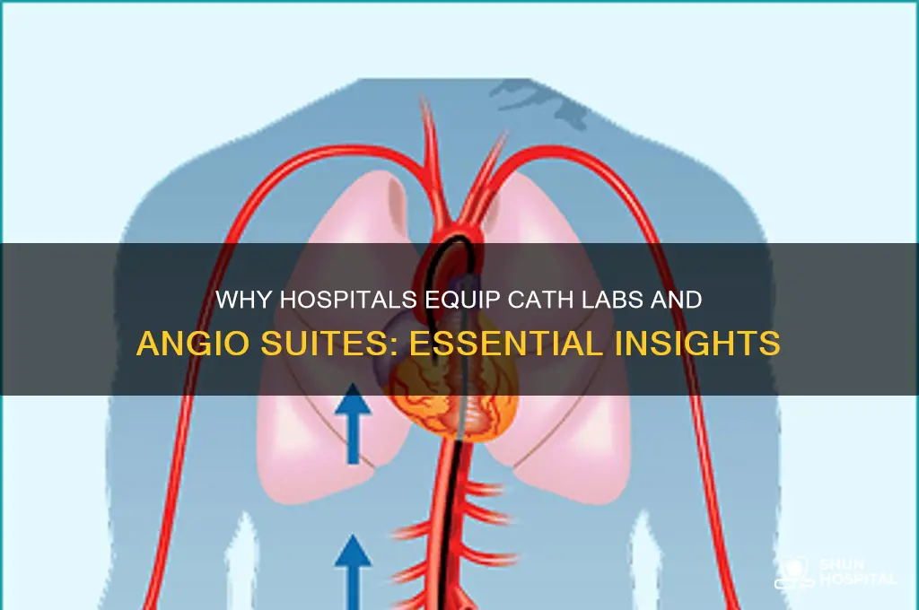 why do some hospitals have cath lab and angio