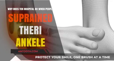 How Hospitals Treat Sprained Ankles: A Comprehensive Guide