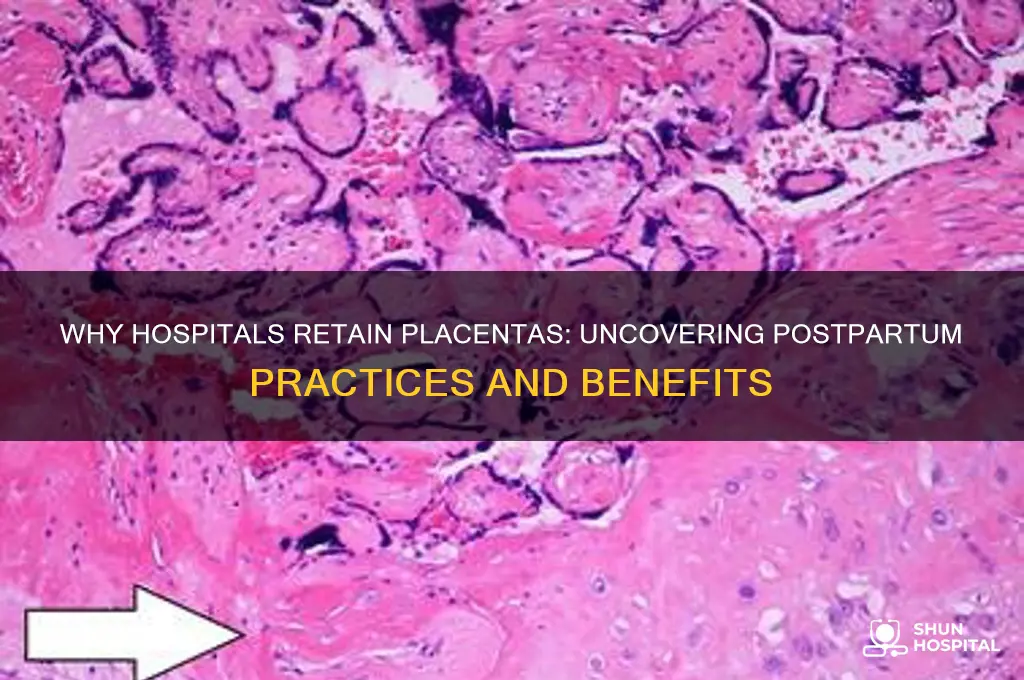 why does the hospital keep the placenta
