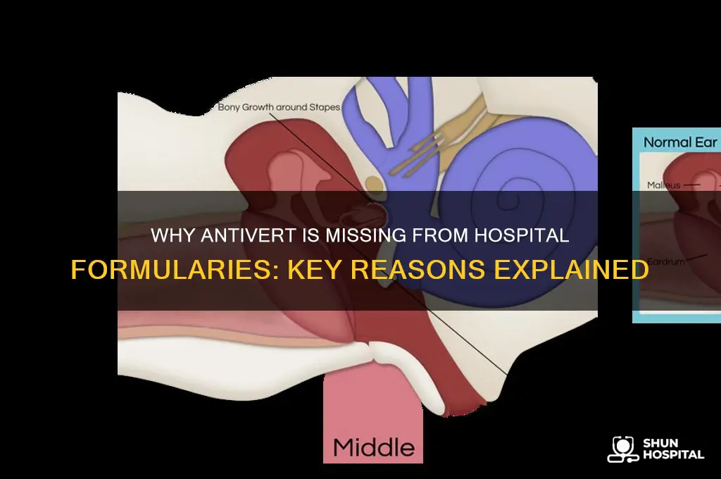 why is antivert not available in hospitals