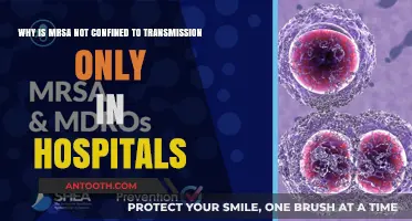 Beyond Hospital Walls: Understanding MRSA's Widespread Community Transmission