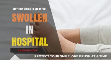Why Hospitals Check for Swollen Feet: Understanding the Medical Importance