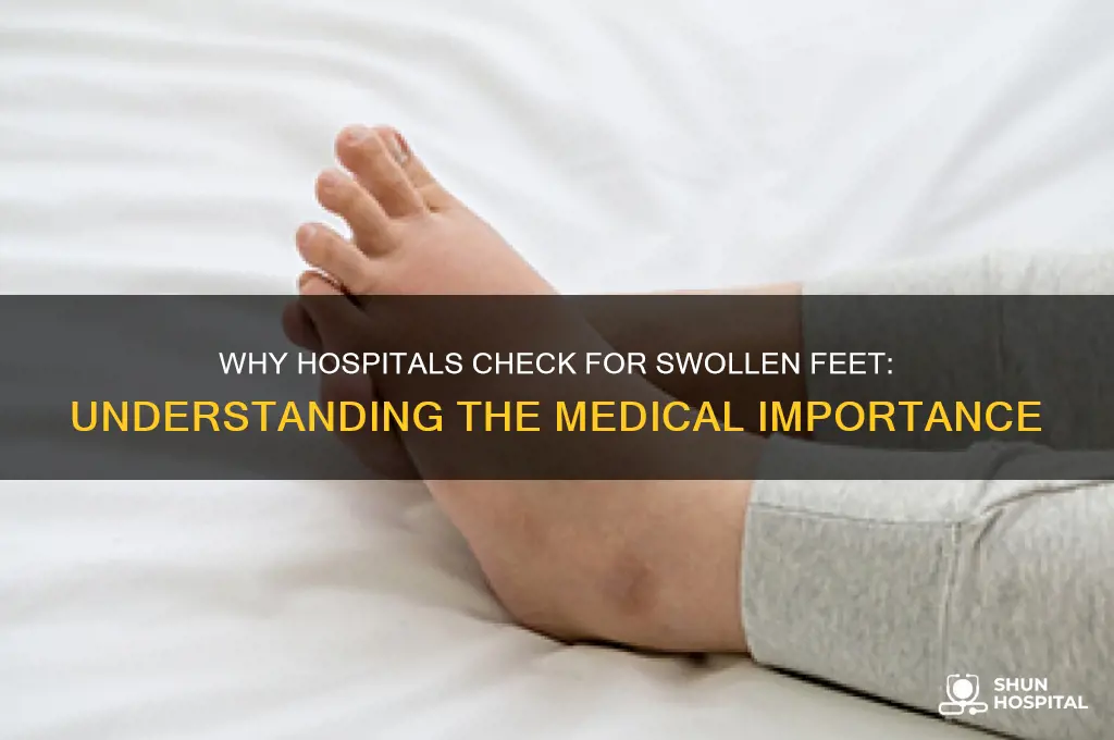 why they check to see if feet swollen in hospital