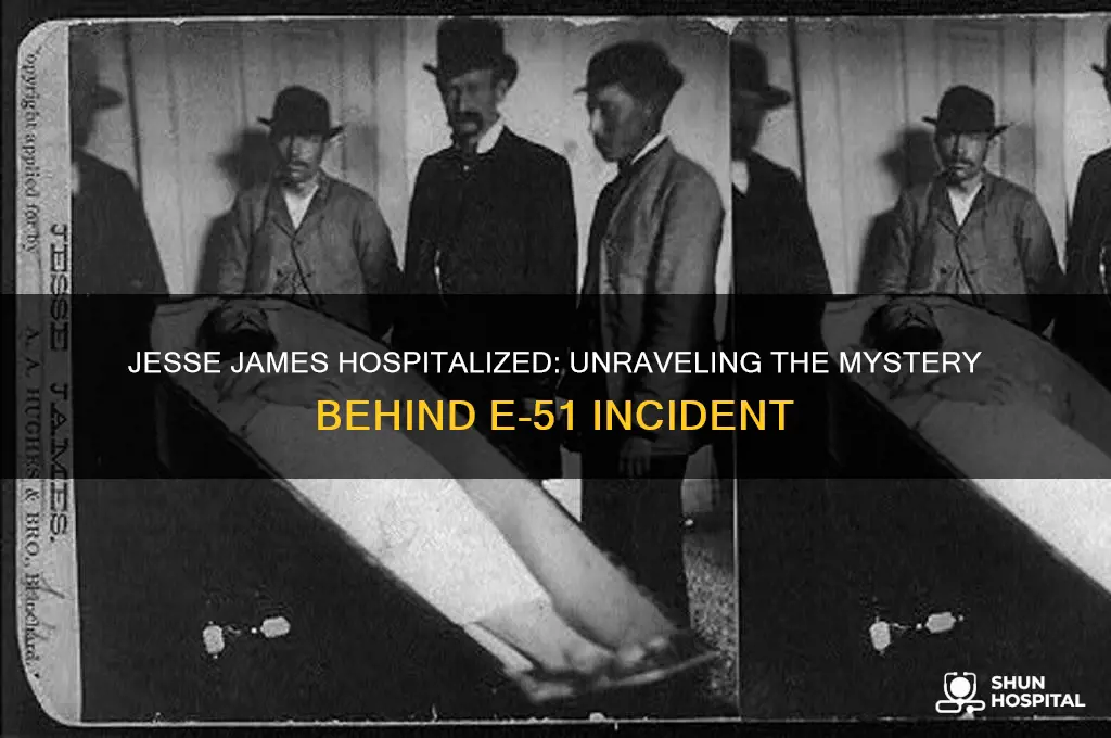 why was jesse james in the hospital e-51