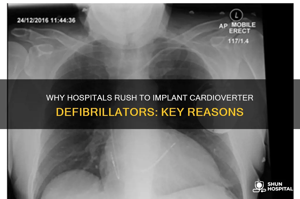 why was the hospital so quick to implanted cardioverter defibrillator