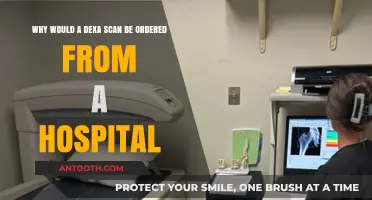 Understanding DEXA Scans: Hospital Reasons for Bone Density Testing