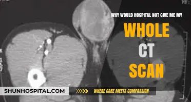 Why Hospitals May Withhold Your Complete CT Scan Results