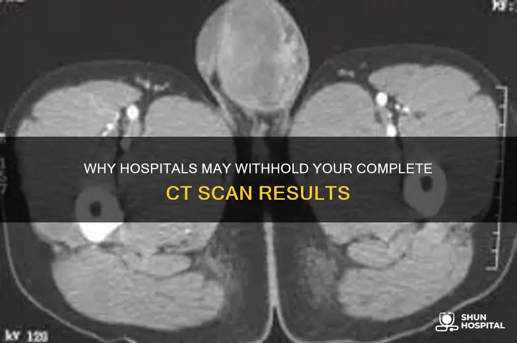 why would hospital not give me my whole ct scan