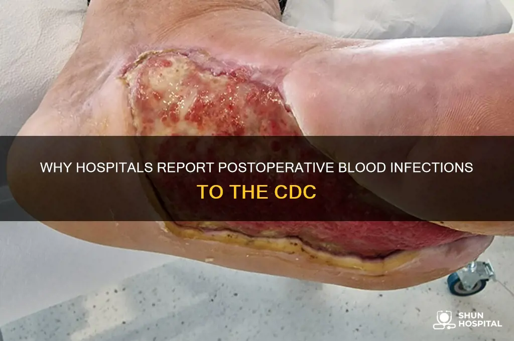 why would hospital send postoperative blood infection results to cdc