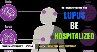 Lupus Hospitalization: When and Why It's Necessary