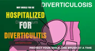 Diverticulitis: When Hospitalization is Necessary