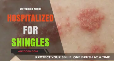 Shingles: Hospitalization and the Risks Involved