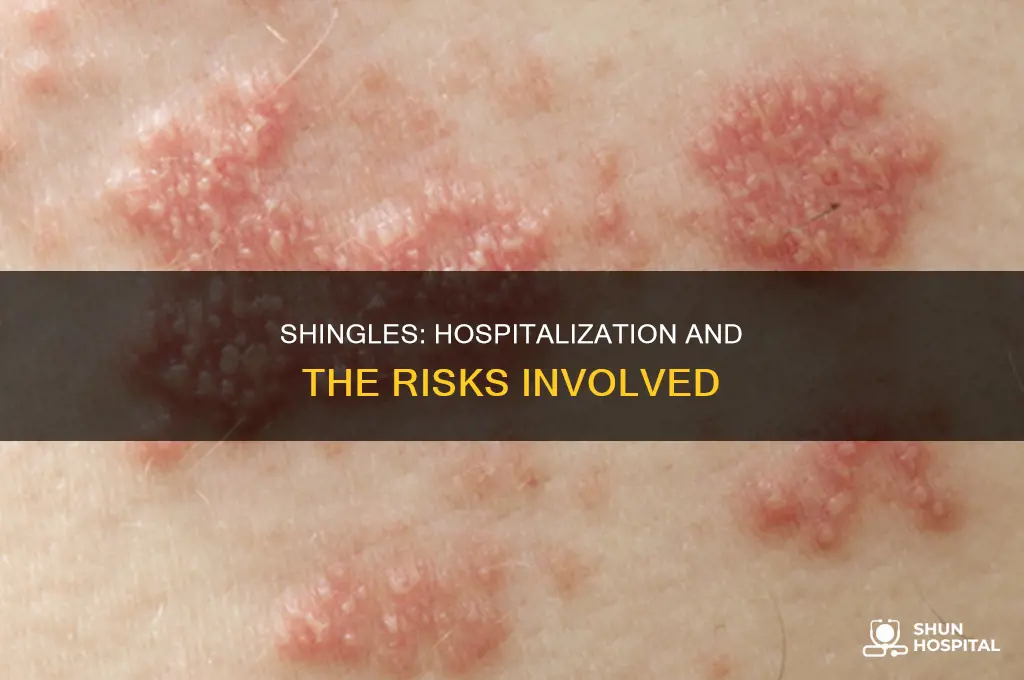 why would you be hospitalized for shingles
