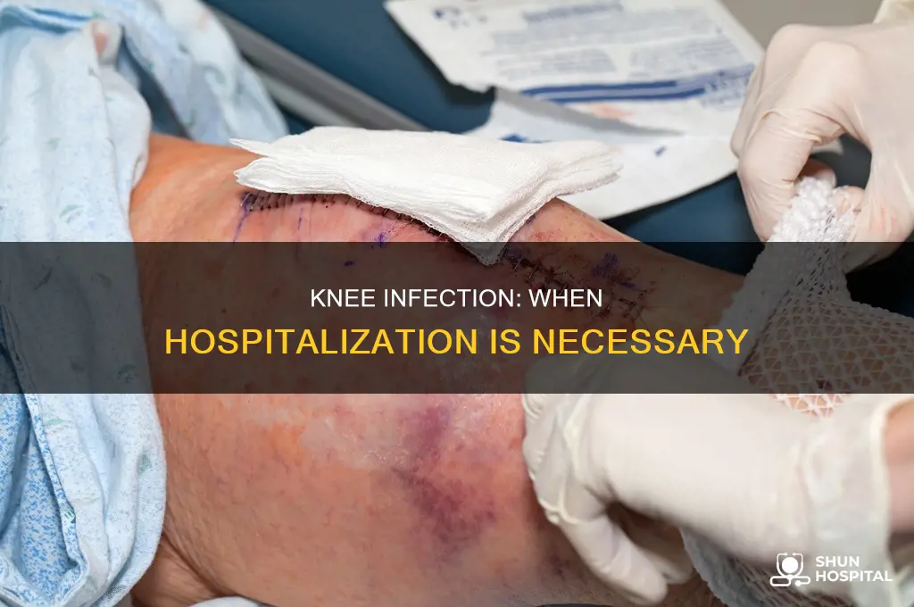 would a knee infection keep you hospital