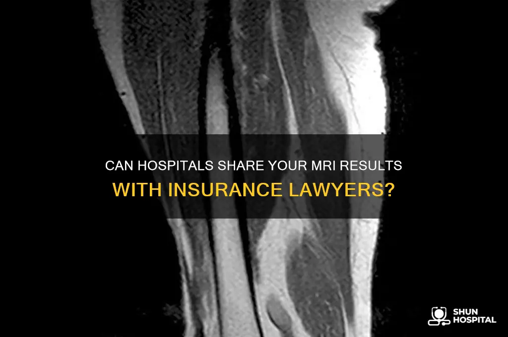 would hospital send results of mri to insurance co lawyer