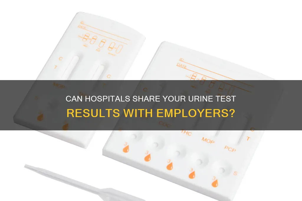 would the hospital give your urine test to your job